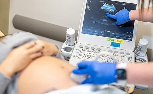 AI-based Pregnancy Analysis Discovers Previously Unknown Warning Signs for Stillbirth and Newborn Complications